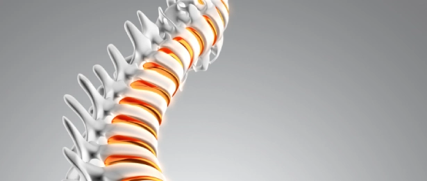 Spina bifida fermée, syndrome de moelle épinière attachée